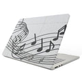 UV-Printed Frosted Case — MacBook Air 11.6 & Pro 13/15 (Legacy)