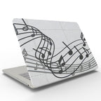 UV-Printed Frosted Case — MacBook Air 11.6 & Pro 13/15 (Legacy)